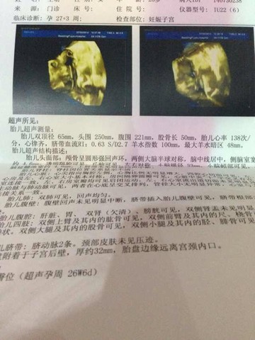 journal_insert_pic_148045155