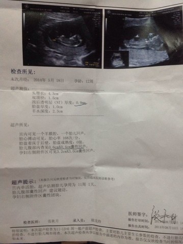 journal_insert_pic_149221298