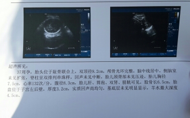 journal_insert_pic_149518452