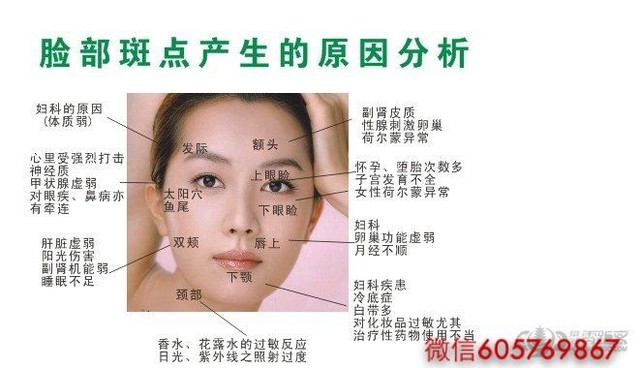 各种斑点的形成原因及解决方法