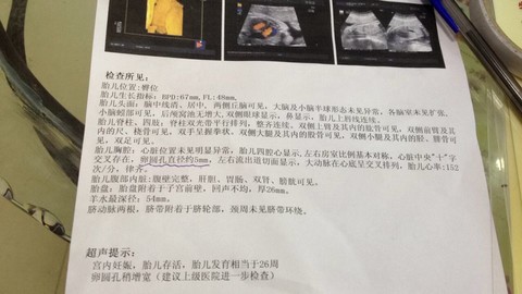 journal_insert_pic_149939540