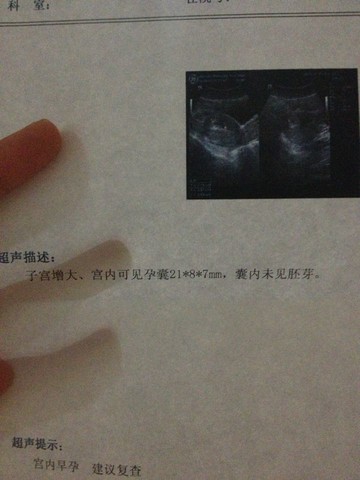journal_insert_pic_150612069