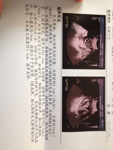 journal_insert_pic_150709931