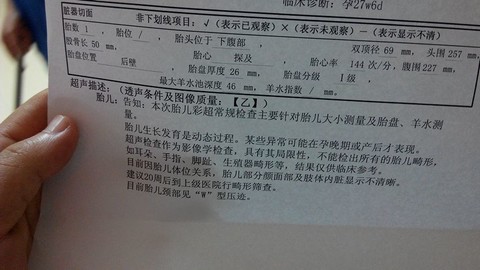 journal_insert_pic_150745487