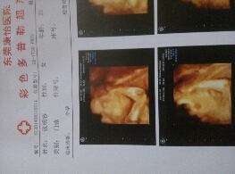 journal_insert_pic_152352989