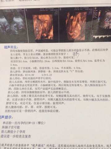 journal_insert_pic_152696886