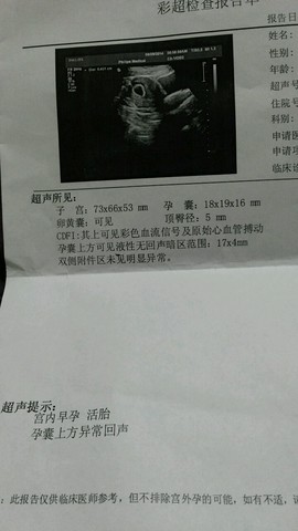 journal_insert_pic_153530545