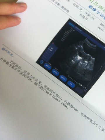journal_insert_pic_154289676