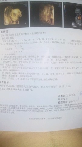 journal_insert_pic_155117671