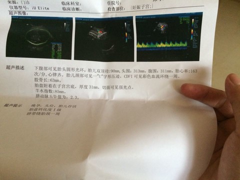 journal_insert_pic_155608576