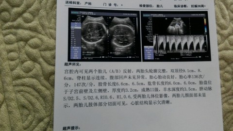 journal_insert_pic_155887335