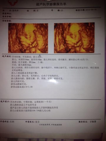 journal_insert_pic_156855950