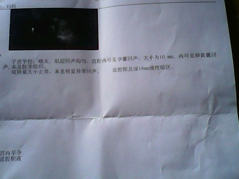 journal_insert_pic_157005339