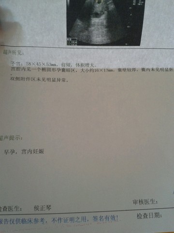 journal_insert_pic_158144785