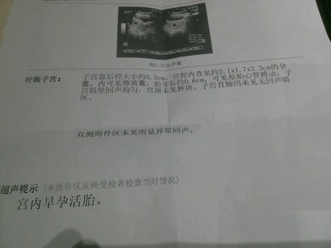 journal_insert_pic_158160786