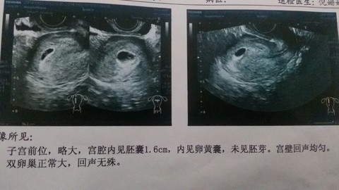 journal_insert_pic_158415891