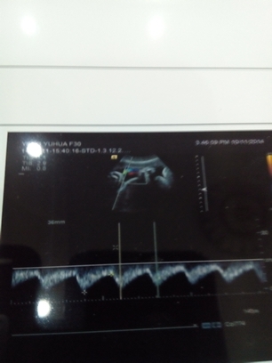 journal_insert_pic_158566804