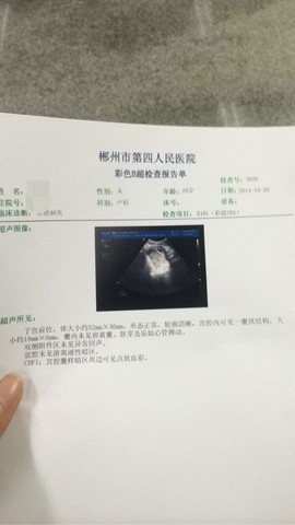 journal_insert_pic_160514594