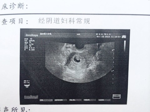 求助贴 怀孕四周 孕囊内混合性结构是什么情况 宝宝树