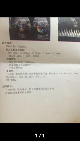 journal_insert_pic_162755438