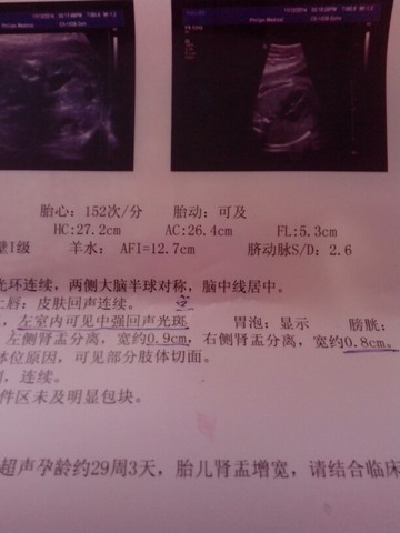 journal_insert_pic_166254973