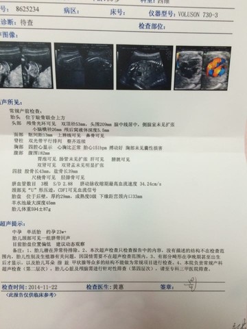 journal_insert_pic_168895208