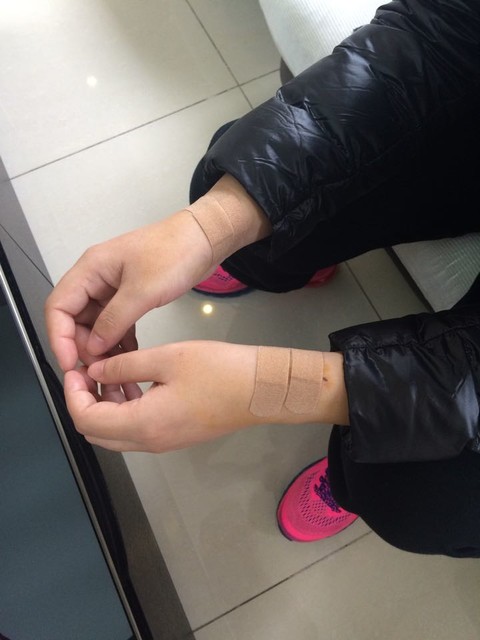 这就是我刚做完 贴的创可贴