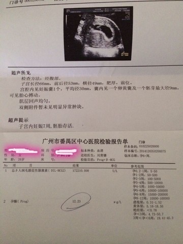 journal_insert_pic_171735399