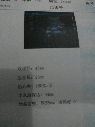 journal_insert_pic_172445349
