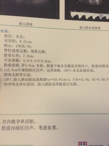 journal_insert_pic_172724132
