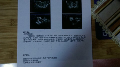 journal_insert_pic_173751164