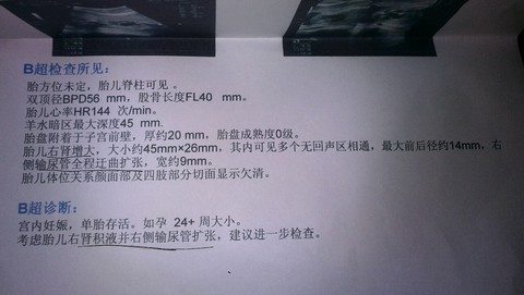 journal_insert_pic_179336404