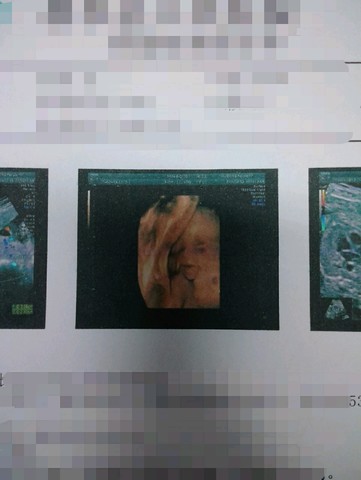 journal_insert_pic_180544739