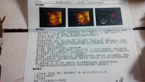 journal_insert_pic_184650497