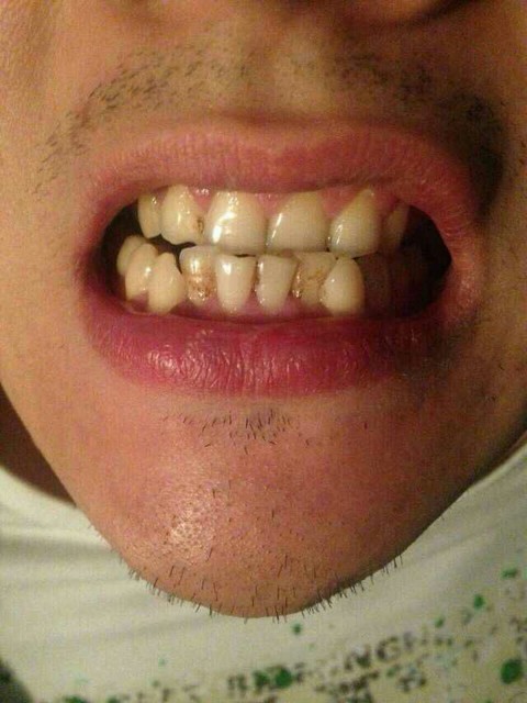 牙齿有黄又黑又很多牙渍的,建议可以试一试这个