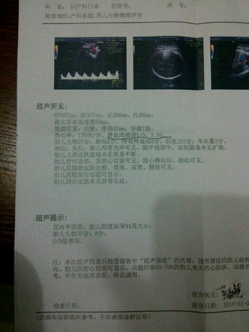 journal_insert_pic_187334830