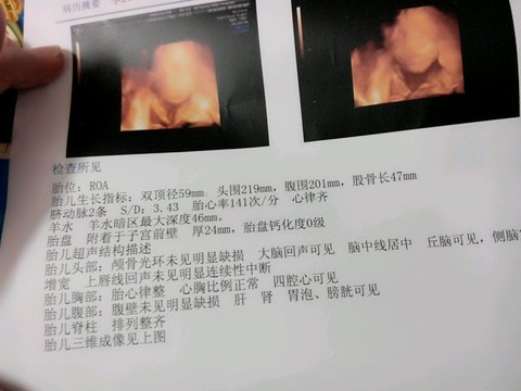 journal_insert_pic_190363018