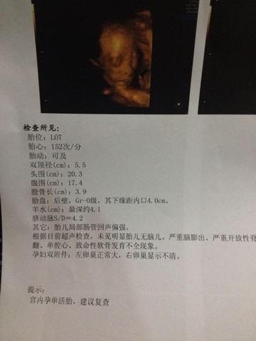 journal_insert_pic_190923120