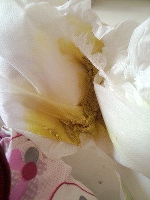 混合喂养宝宝拉屎总是黄绿色,有没有姐妹的宝宝也是这样