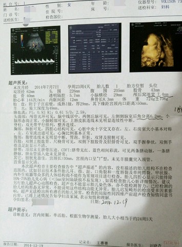 journal_insert_pic_194304850