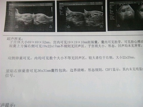 journal_insert_pic_200066227