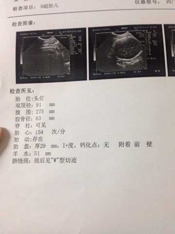 journal_insert_pic_202080383