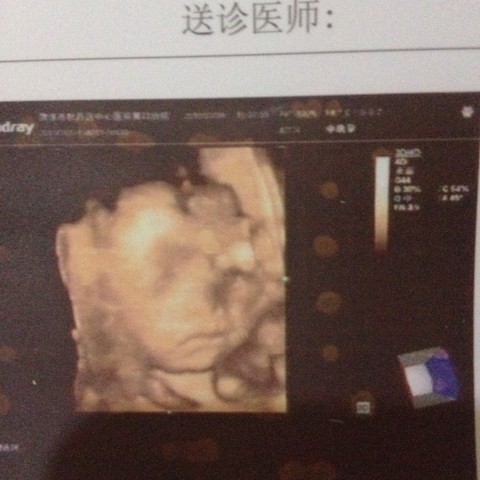 journal_insert_pic_204998728