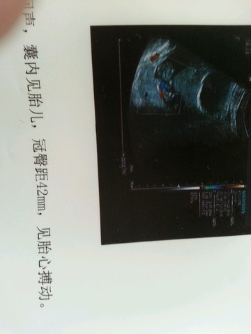 journal_insert_pic_206228487
