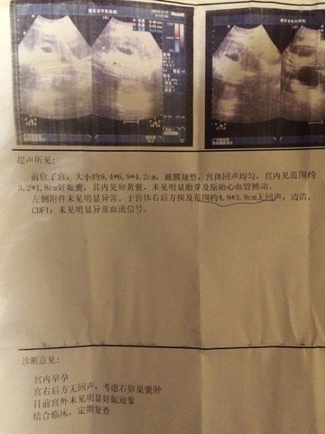 journal_insert_pic_207005755