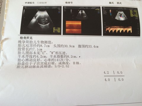 journal_insert_pic_212316692