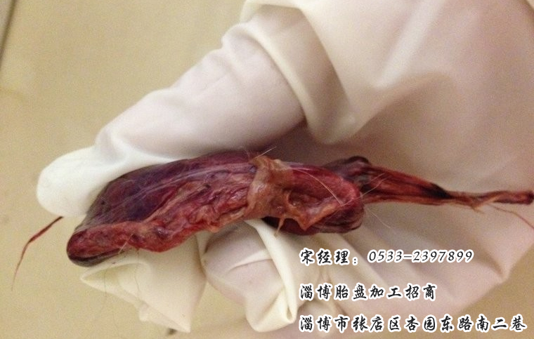 胎盘都怎么处理了