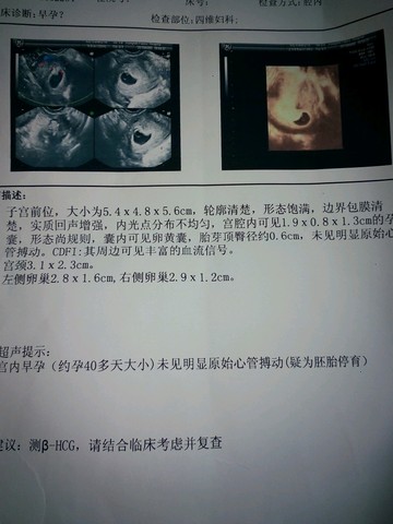 journal_insert_pic_215408107