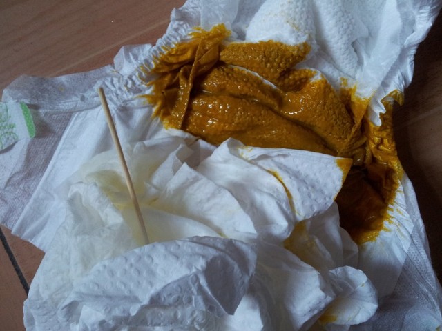 4个半月不会翻身,大便稀