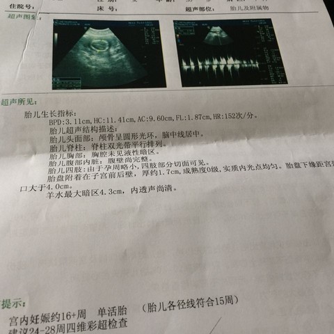 journal_insert_pic_217951670